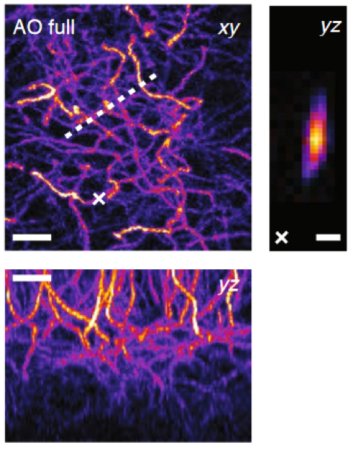 Multiphoton microscopy - Class 5 Photonics